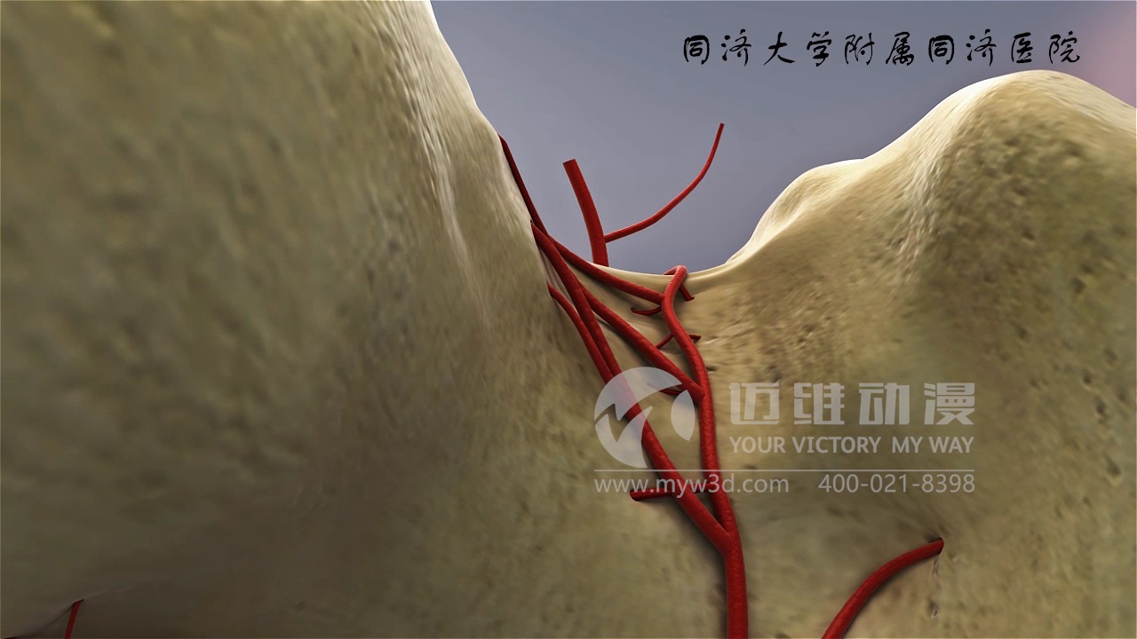 醫(yī)學(xué)仿真三維動畫演示 醫(yī)學(xué)仿真三維動畫演示