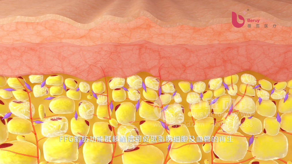 醫(yī)學(xué)醫(yī)療三維動(dòng)畫 醫(yī)學(xué)醫(yī)療三維動(dòng)畫