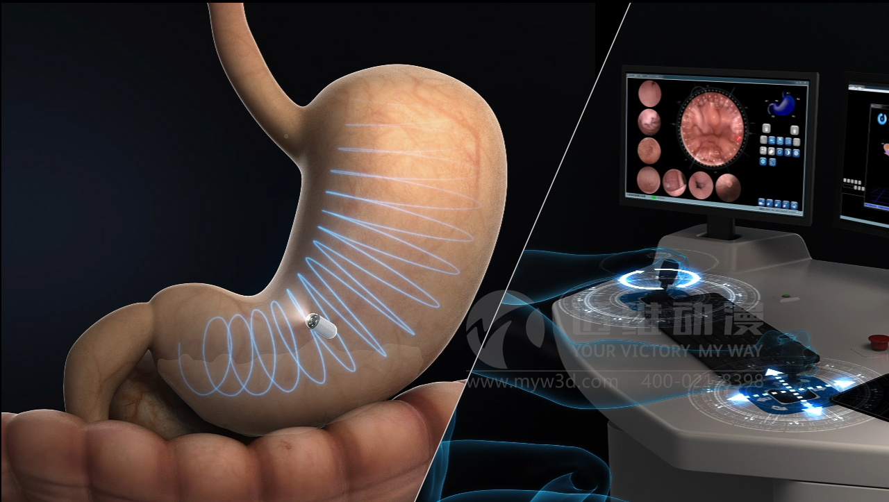 醫(yī)學(xué)醫(yī)療三維動(dòng)畫在醫(yī)療行業(yè)中的應(yīng)用及優(yōu)勢(圖1)