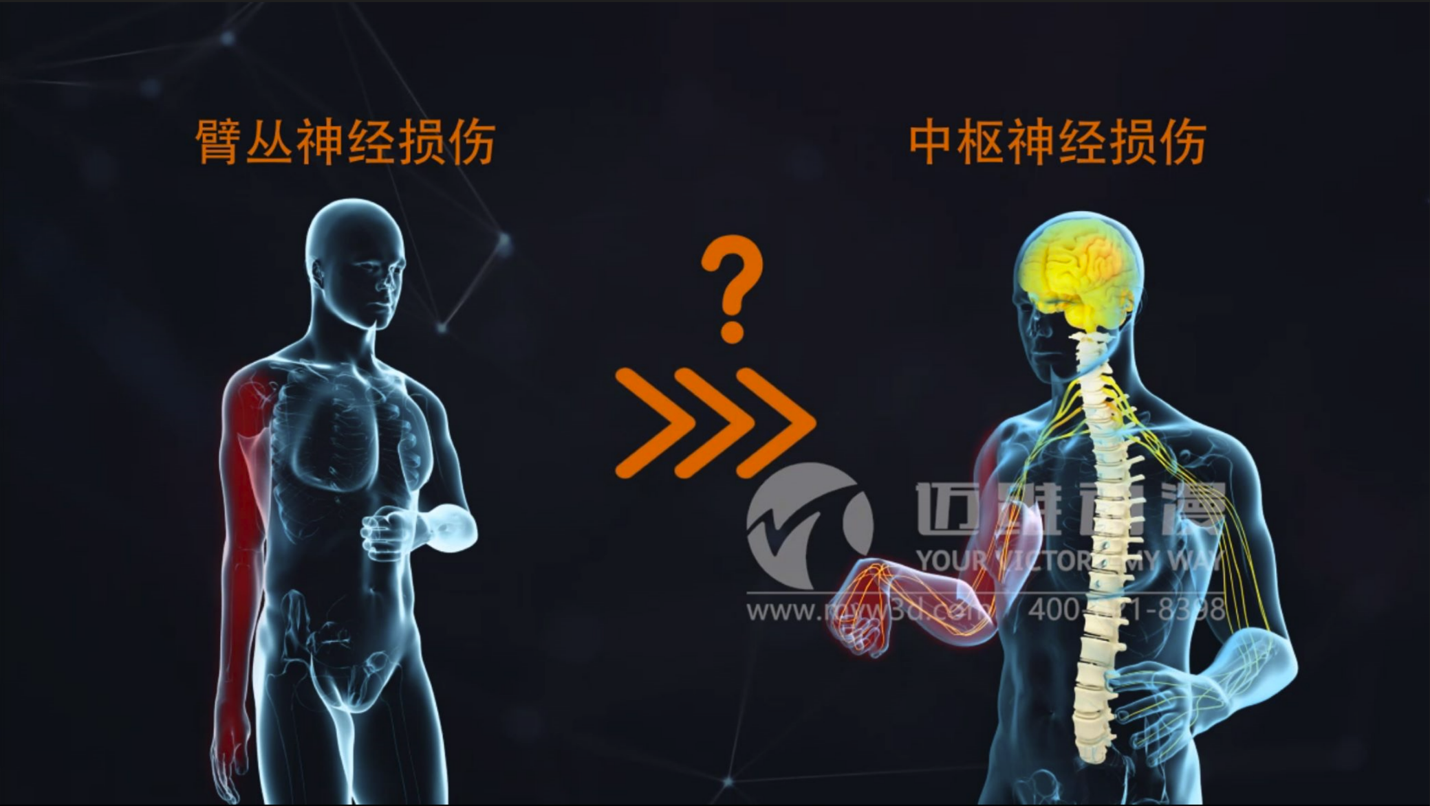 三維動(dòng)畫對(duì)醫(yī)療行業(yè)的影響(圖1) 三維動(dòng)畫對(duì)醫(yī)療行業(yè)的影響(圖1)