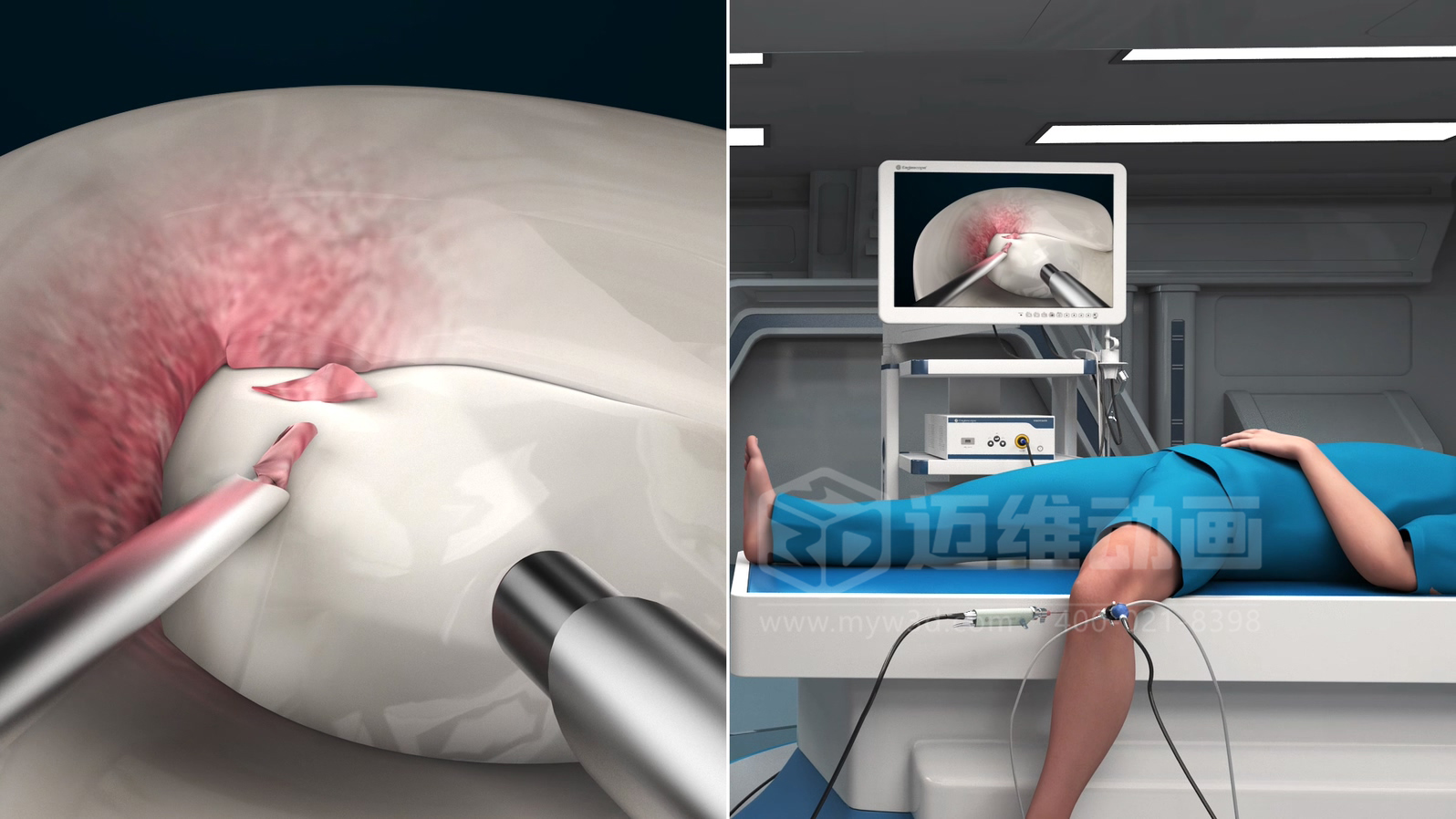 醫(yī)學(xué)手術(shù)三維動(dòng)畫(huà)制作公司哪家好？解碼上海邁維動(dòng)漫的醫(yī)學(xué)醫(yī)療3D可視化創(chuàng)新之路(圖2)