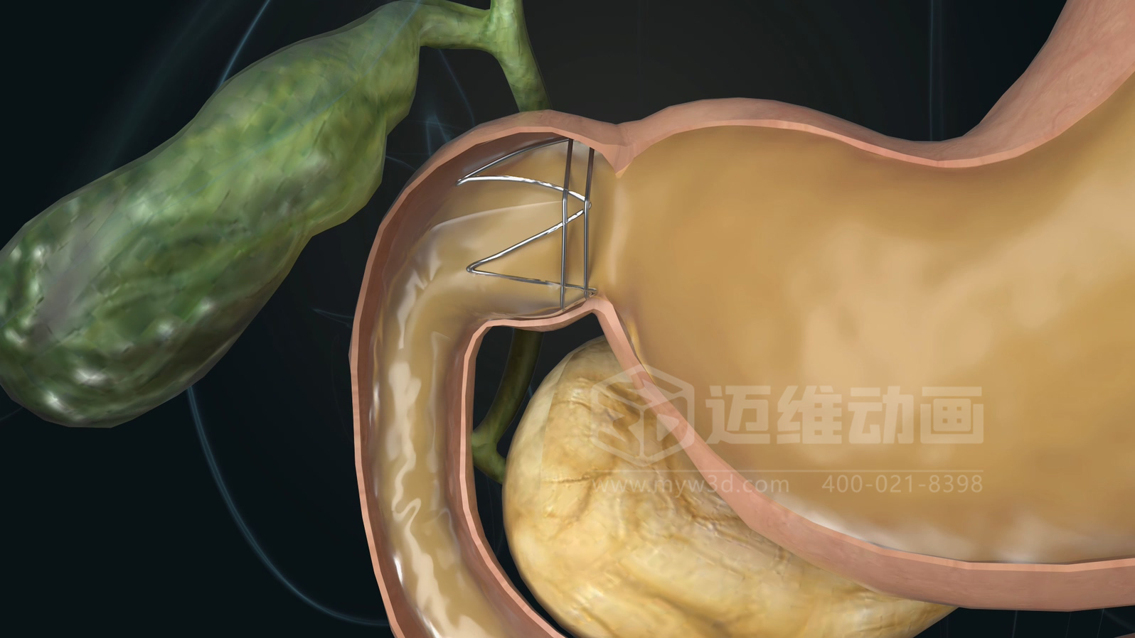 醫(yī)學(xué)科普從來不是 “天書”：三維動(dòng)畫讓復(fù)雜科學(xué)原理輕松 get！(圖12)