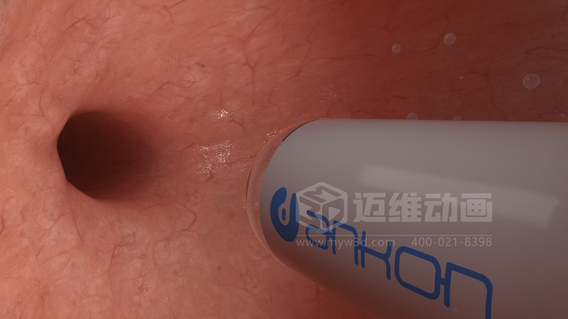 醫(yī)學(xué)檢測設(shè)備如何突破消化道檢查壁壘？三維動(dòng)畫還原核心技術(shù)與臨床價(jià)值(圖4)