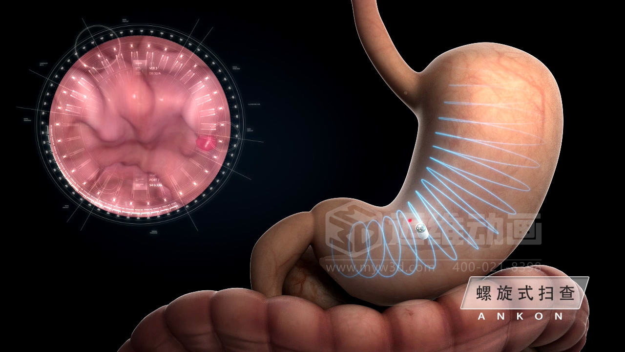 從 “看不懂” 到 “秒懂”，醫(yī)學(xué)醫(yī)療三維動畫憑什么兼顧專業(yè)度與傳播力？(圖5)